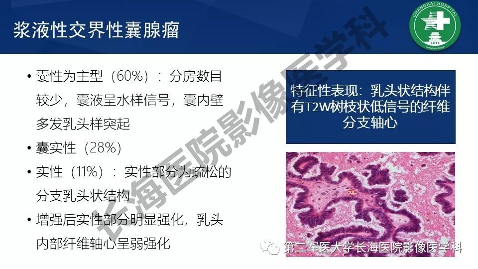【PPT】卵巢上皮性肿瘤影像诊断