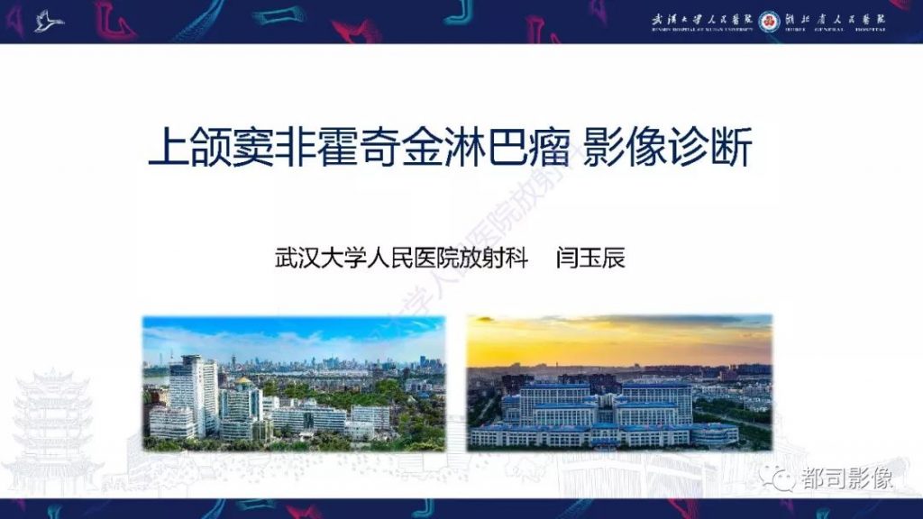【PPT】上颌窦非霍奇金淋巴瘤影像诊断