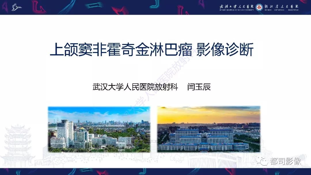 【PPT】上颌窦非霍奇金淋巴瘤影像诊断