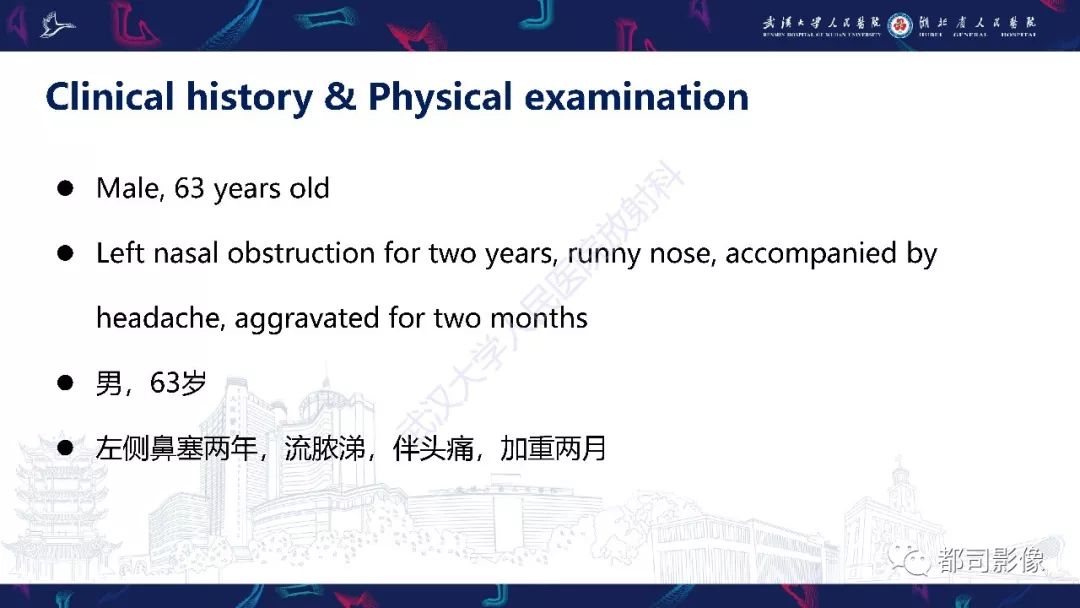 【PPT】上颌窦非霍奇金淋巴瘤影像诊断