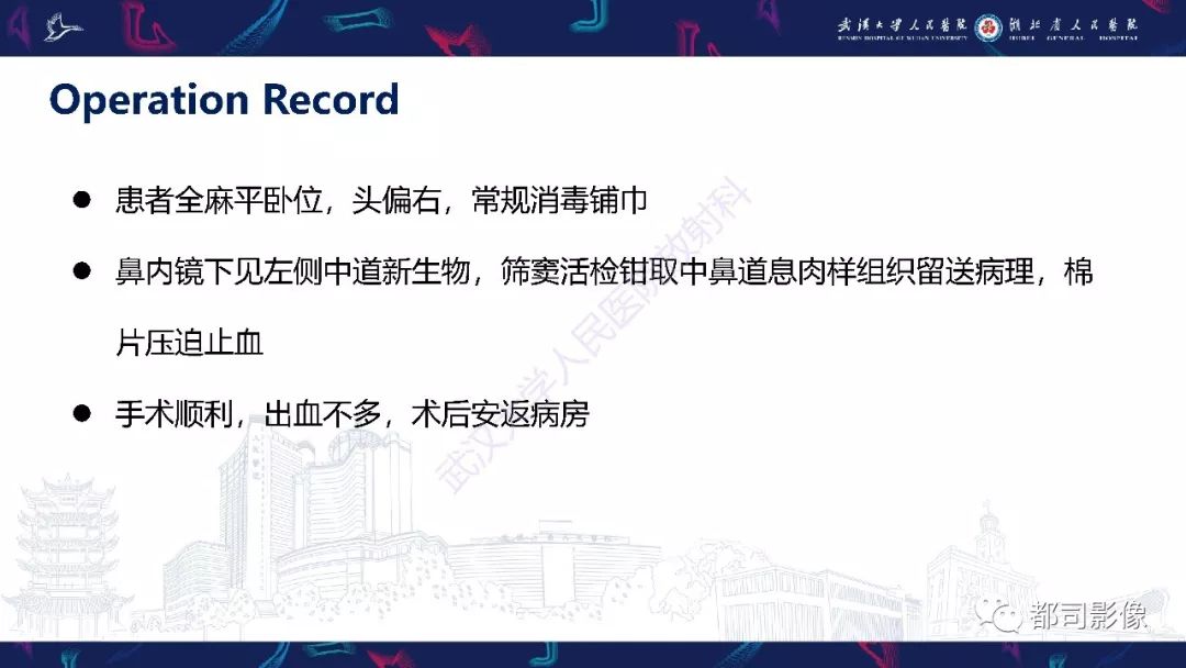 【PPT】上颌窦非霍奇金淋巴瘤影像诊断