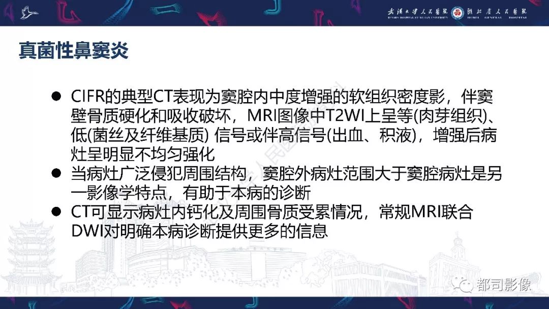 【PPT】上颌窦非霍奇金淋巴瘤影像诊断
