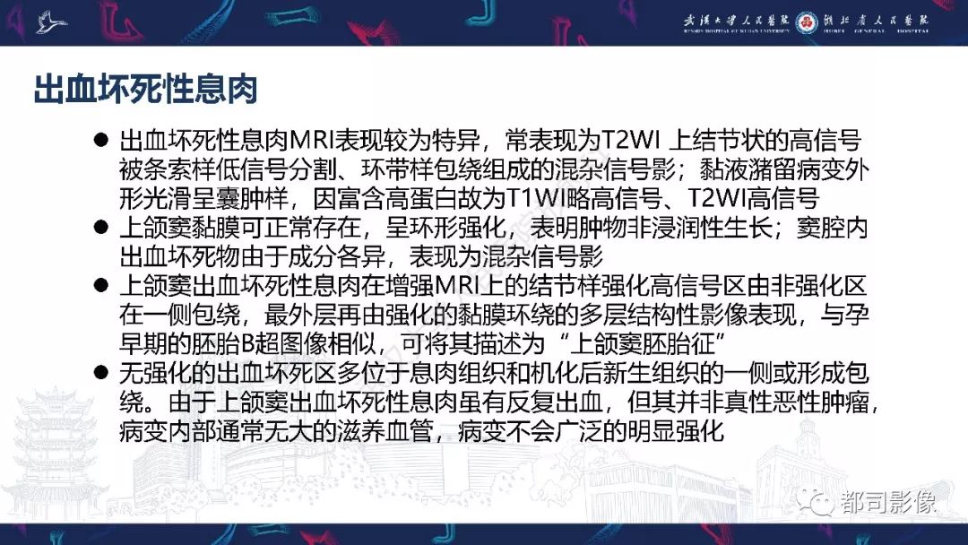 【PPT】上颌窦非霍奇金淋巴瘤影像诊断