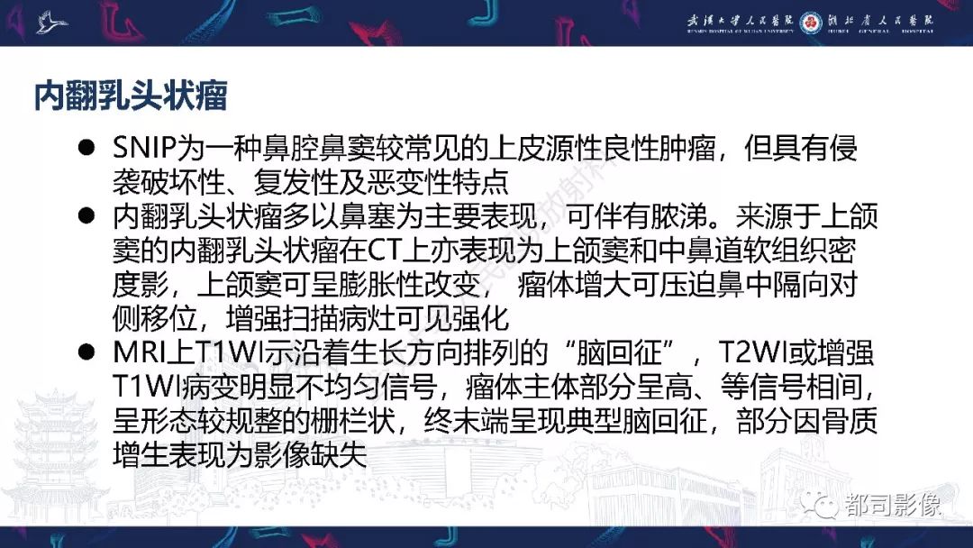 【PPT】上颌窦非霍奇金淋巴瘤影像诊断