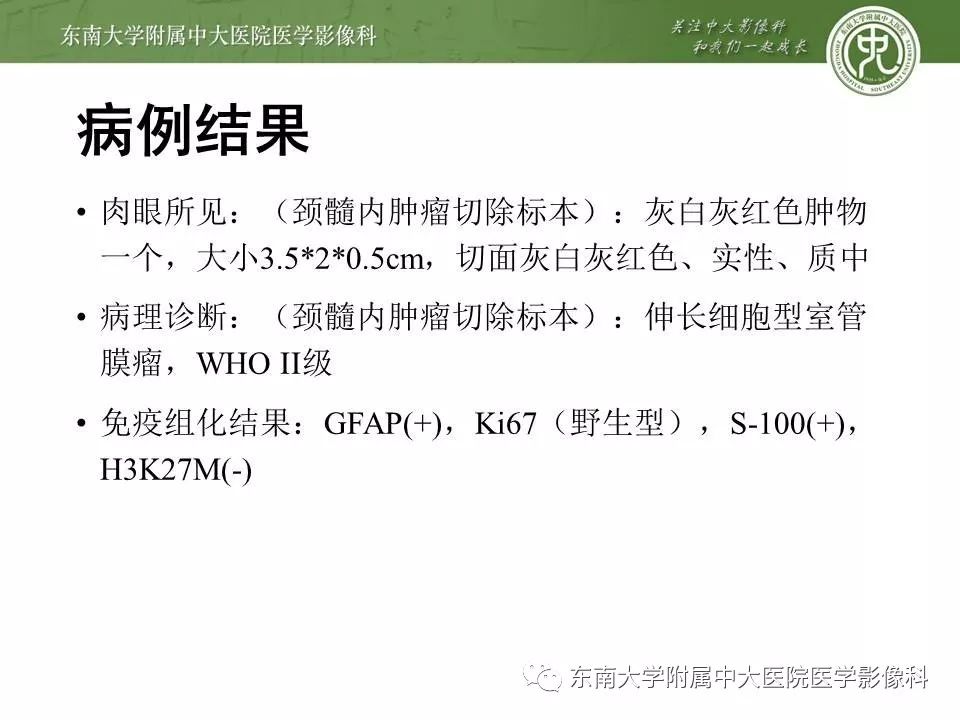 【病例】髓内室管膜瘤1例MR影像
