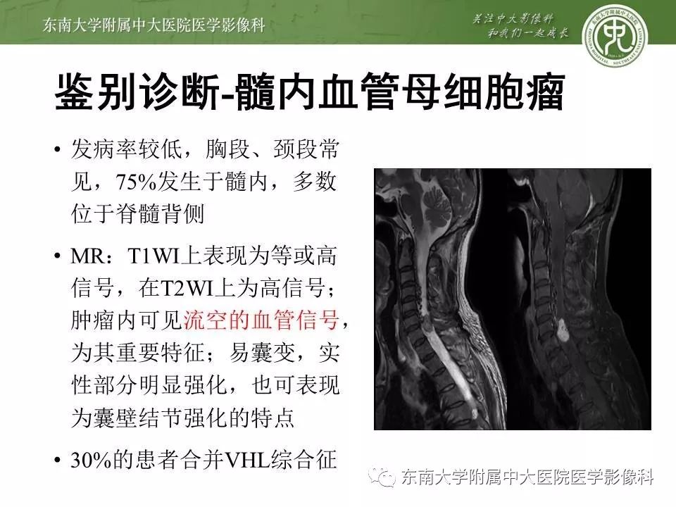 【病例】髓内室管膜瘤1例MR影像