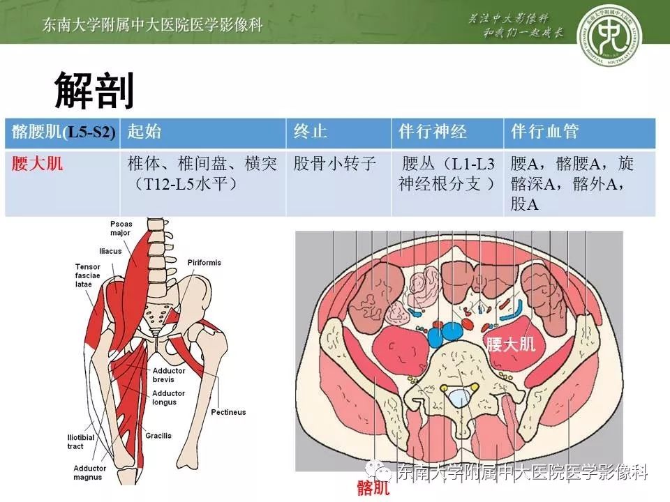 【病例】腰大肌脓肿1例CT影像