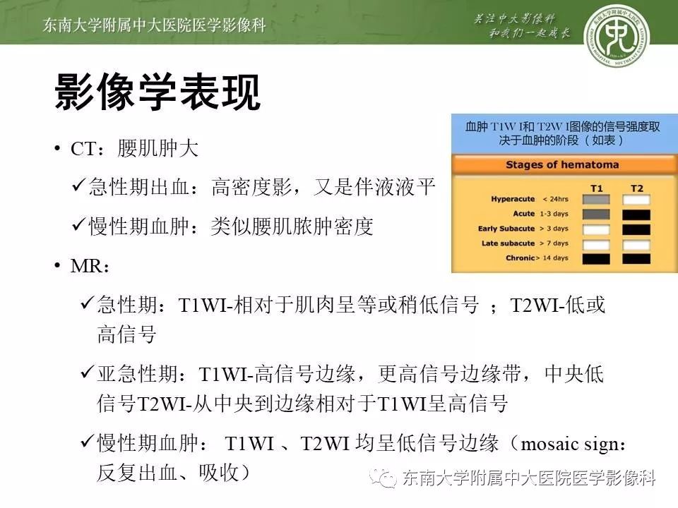 【病例】腰大肌脓肿1例CT影像
