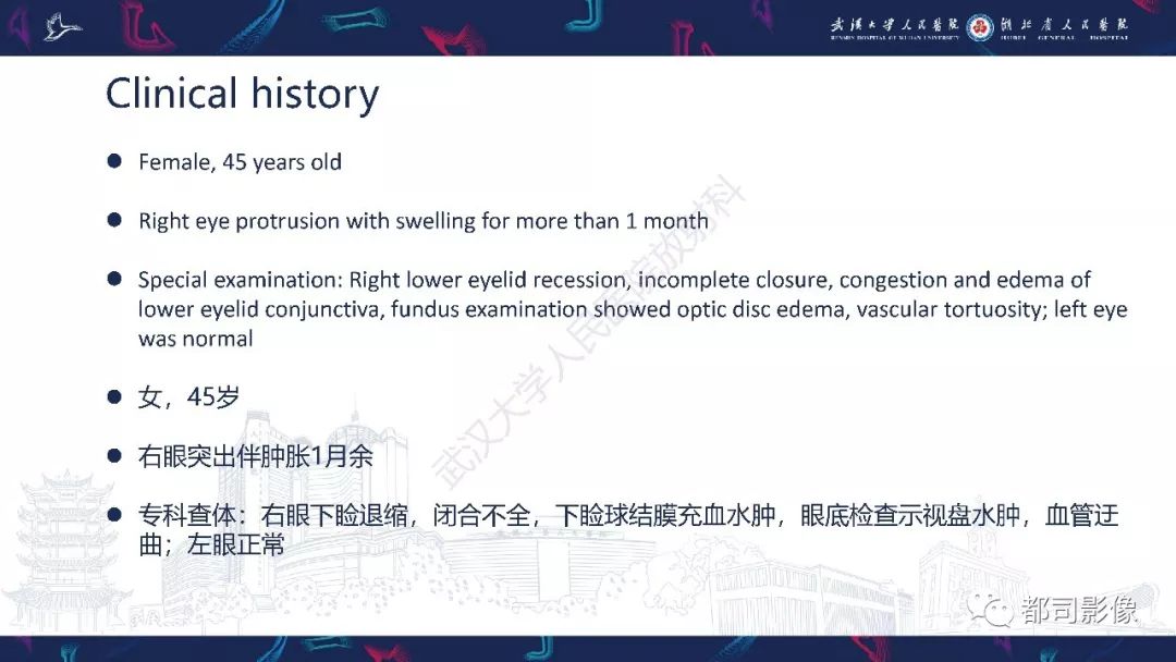 【PPT】眼眶胚胎性横纹肌肉瘤影像诊断