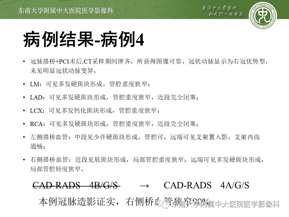 【PPT】冠脉疾病-报告和数据系统易混淆点