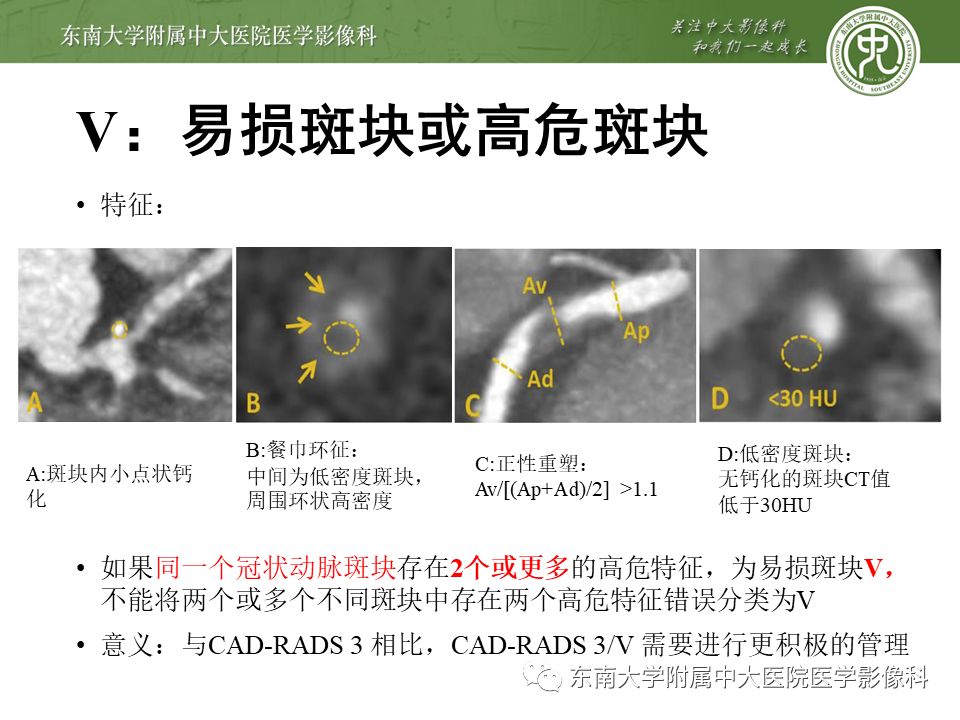 【PPT】冠脉疾病-报告和数据系统易混淆点