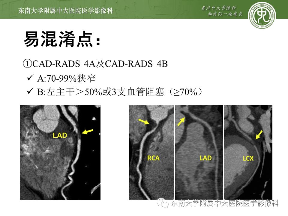 【PPT】冠脉疾病-报告和数据系统易混淆点