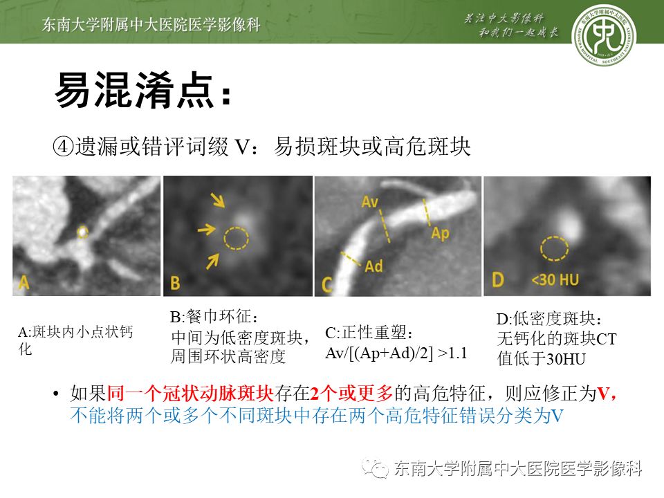 【PPT】冠脉疾病-报告和数据系统易混淆点
