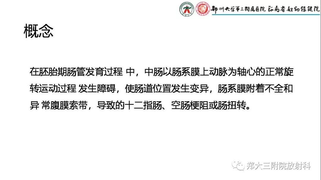 【PPT】先天性肠旋转不良的影像诊断