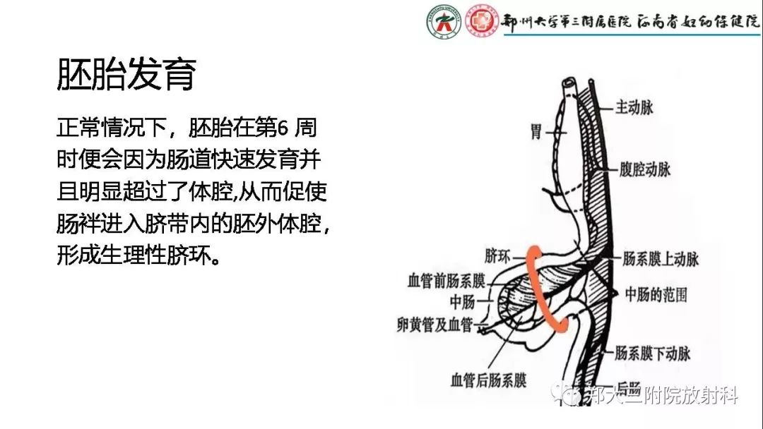 【PPT】先天性肠旋转不良的影像诊断