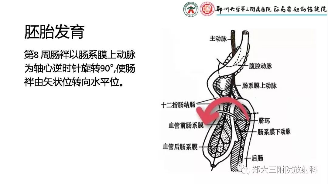 【PPT】先天性肠旋转不良的影像诊断