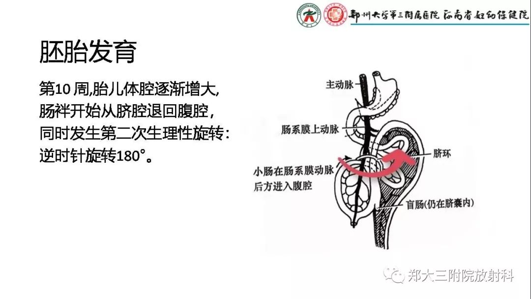 【PPT】先天性肠旋转不良的影像诊断