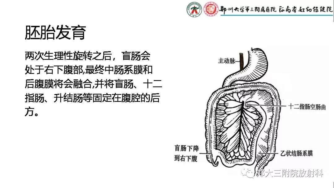 【PPT】先天性肠旋转不良的影像诊断