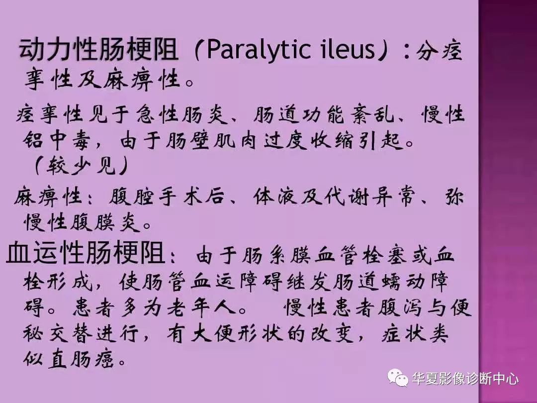【PPT】小肠梗阻的CT诊断—肠梗阻的梗阻点的寻找