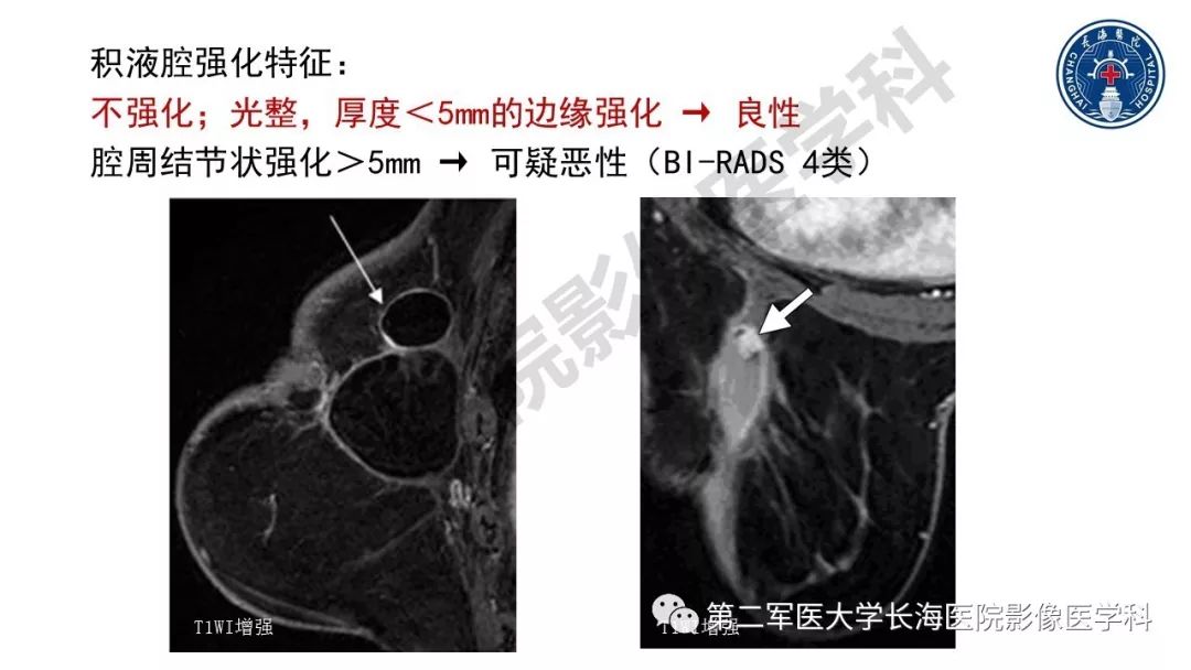 【PPT】乳腺癌保乳治疗后常见MR表现