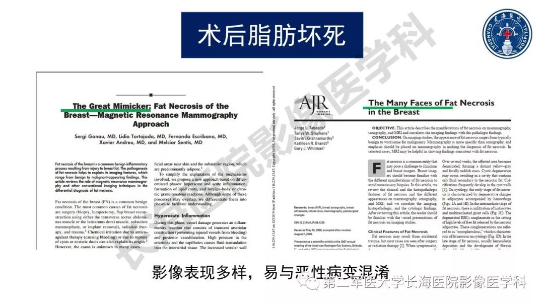 【PPT】乳腺癌保乳治疗后常见MR表现