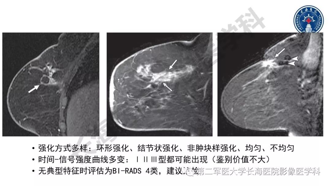 【PPT】乳腺癌保乳治疗后常见MR表现