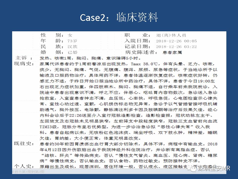 【病例】致心律失常性右室心肌病2例MR影像