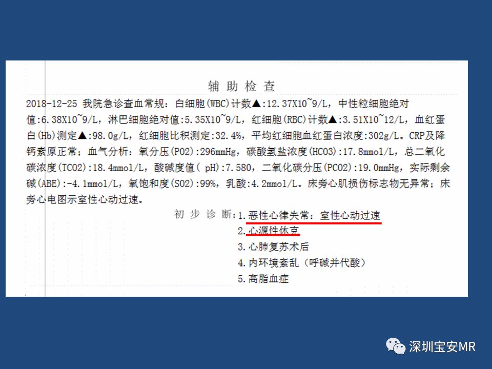 【病例】致心律失常性右室心肌病2例MR影像