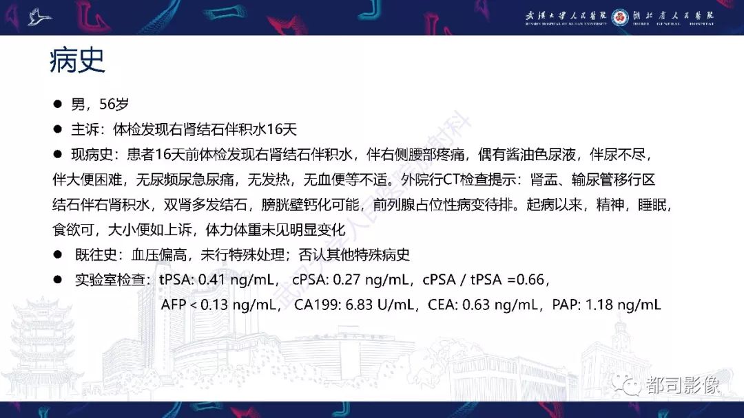 【PPT】前列腺胃肠外间质瘤影像诊断