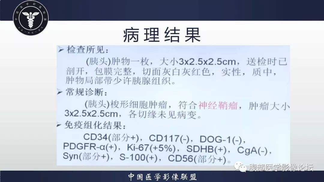 【病例】胰头神经鞘瘤1例MR