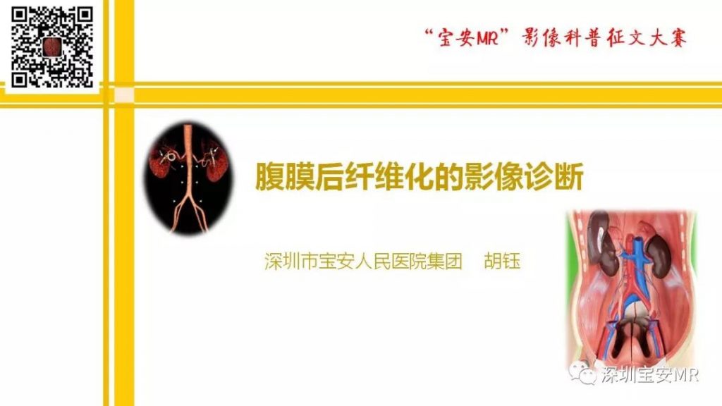 【PPT】腹膜后纤维化的影像诊断