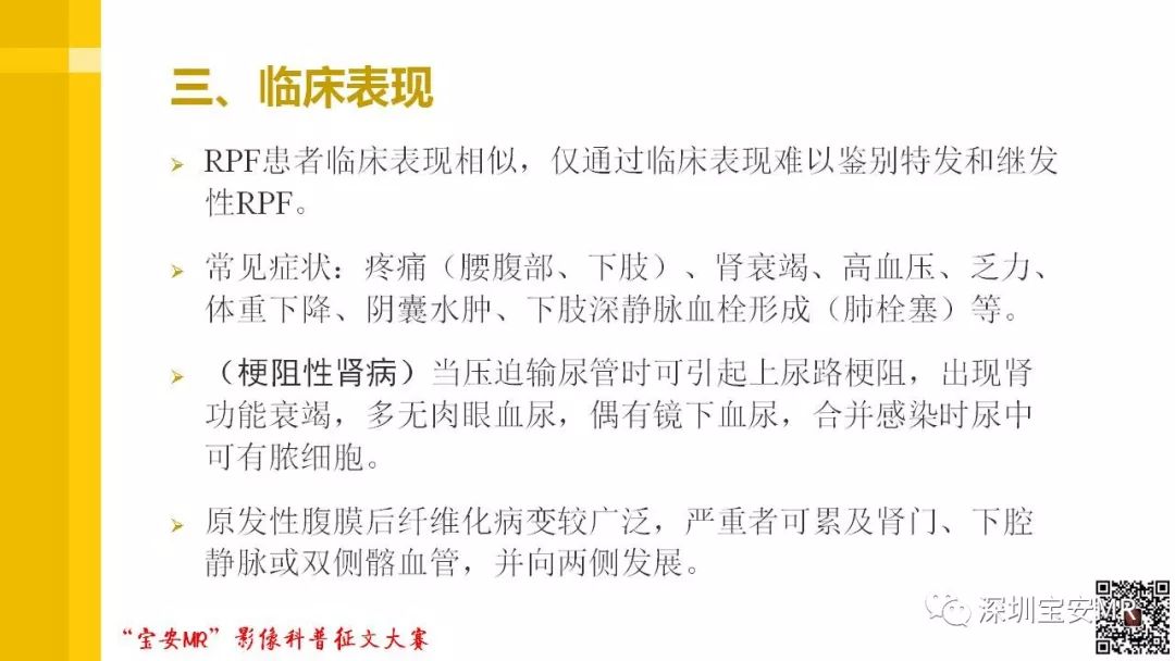 【PPT】腹膜后纤维化的影像诊断