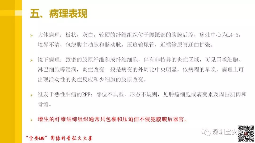 【PPT】腹膜后纤维化的影像诊断