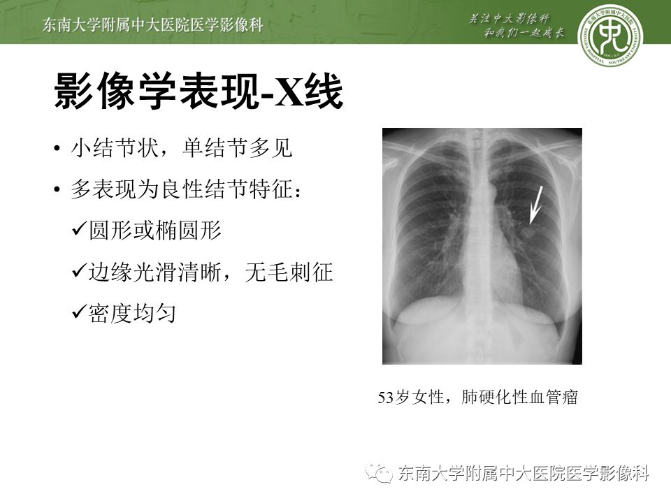 【病例】肺硬化性肺泡细胞瘤/硬化性血管瘤1例CT影像