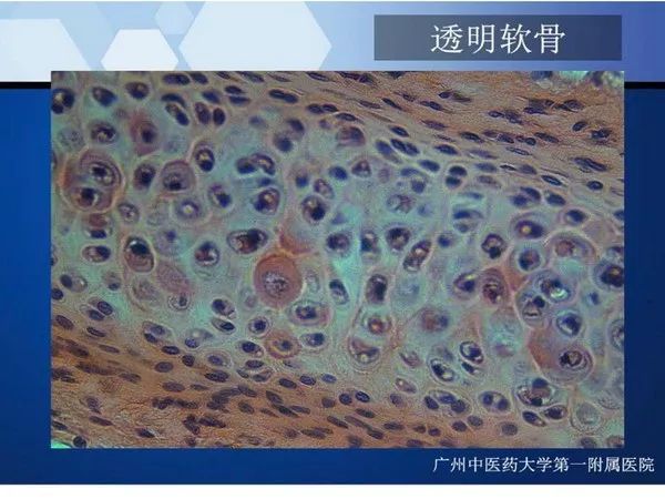 【PPT】不同部位软骨瘤影像诊断