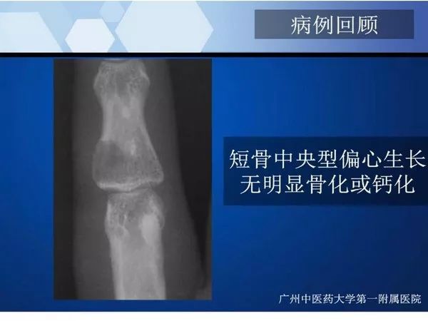 【PPT】不同部位软骨瘤影像诊断