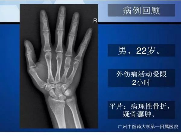 【PPT】不同部位软骨瘤影像诊断