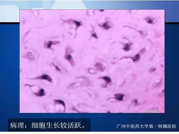 【PPT】不同部位软骨瘤影像诊断