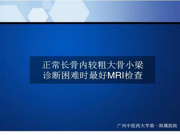 【PPT】不同部位软骨瘤影像诊断