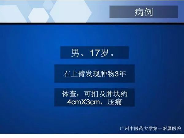 【PPT】不同部位软骨瘤影像诊断