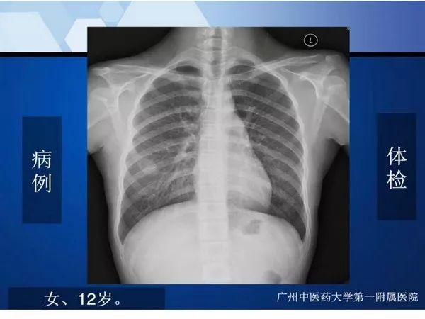 【PPT】不同部位软骨瘤影像诊断