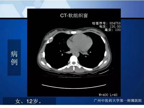 【PPT】不同部位软骨瘤影像诊断