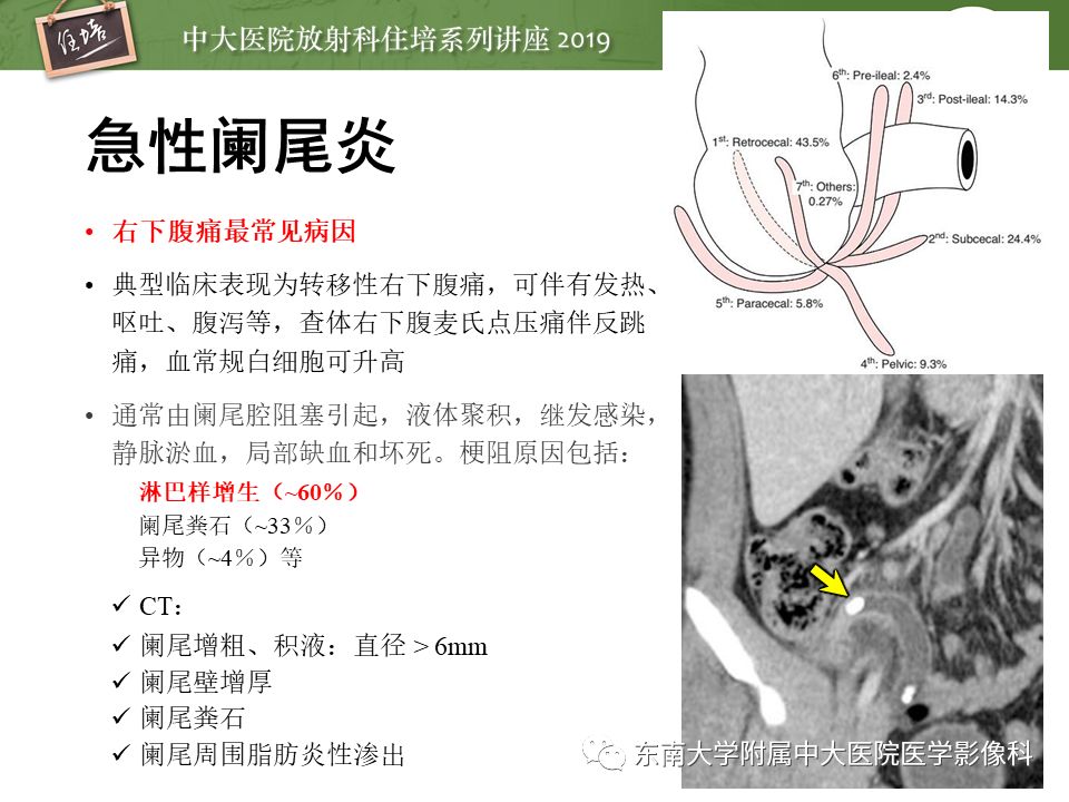 【PPT】肠道急腹症的影像诊断