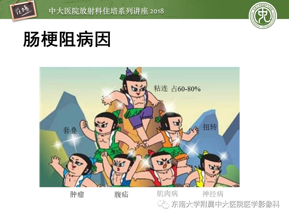 【PPT】肠道急腹症的影像诊断