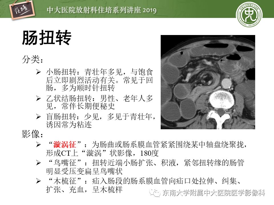 【PPT】肠道急腹症的影像诊断