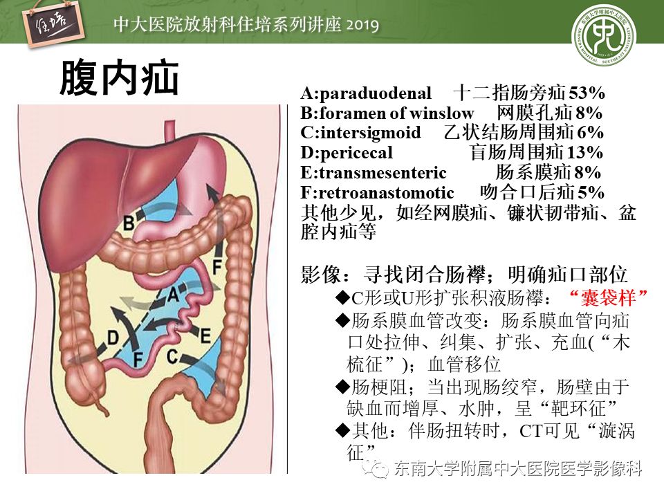【PPT】肠道急腹症的影像诊断