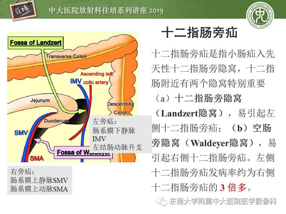 【PPT】肠道急腹症的影像诊断