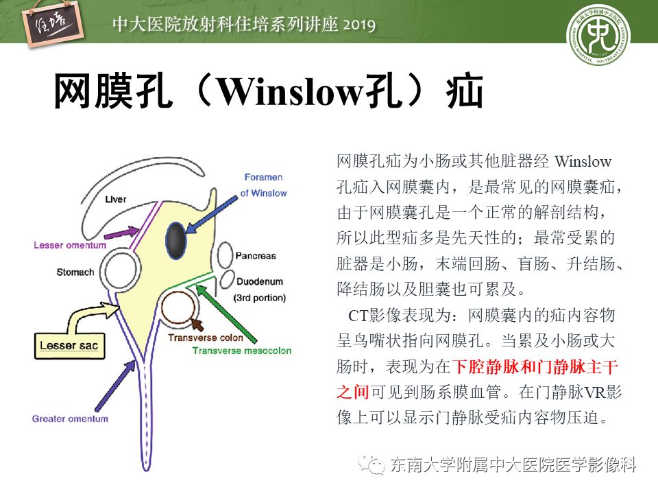 【PPT】肠道急腹症的影像诊断