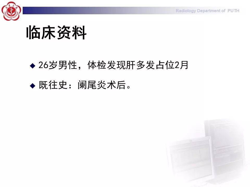 【病例】肝脏上皮样血管内皮瘤1例CT及MR