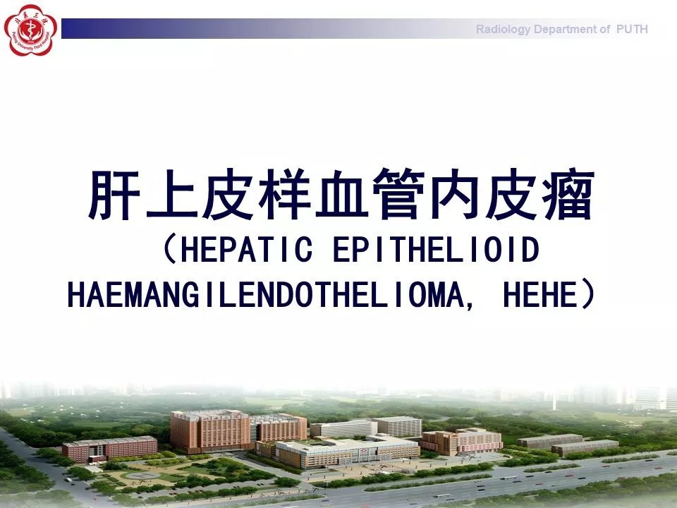 【病例】肝脏上皮样血管内皮瘤1例CT及MR
